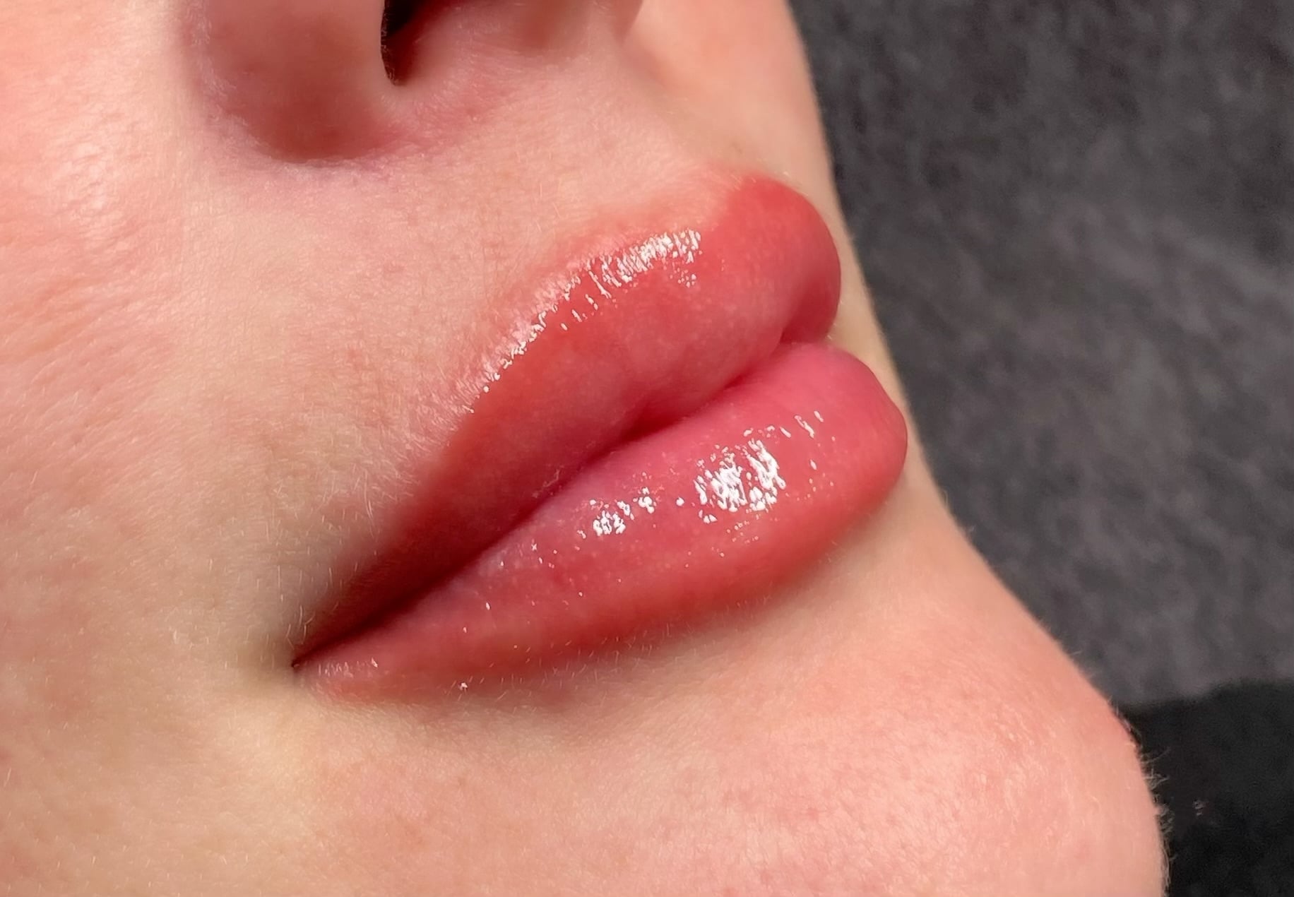 Resultaat van Lipblush behandeling